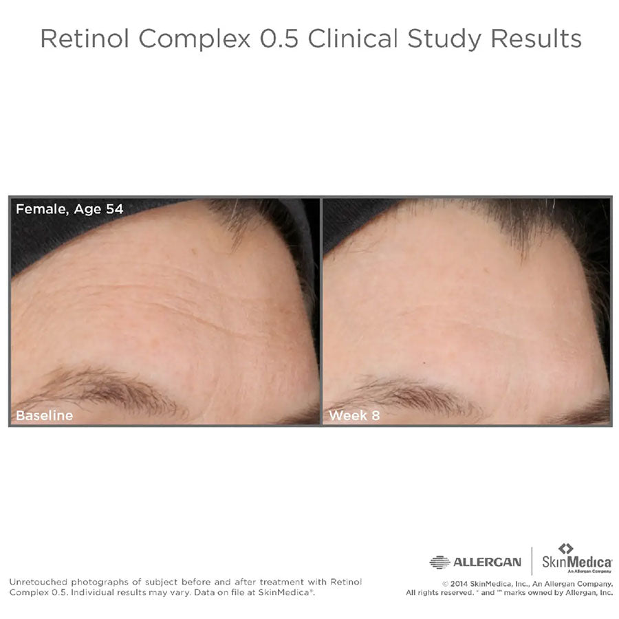 SkinMedica Retinol Complex 0.5 før og etter
