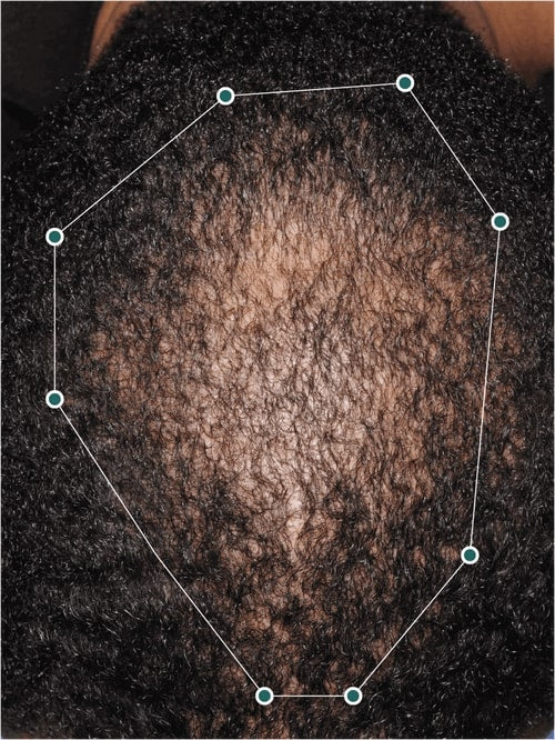 Nutrafol muški komplet za potpuni rast kose
