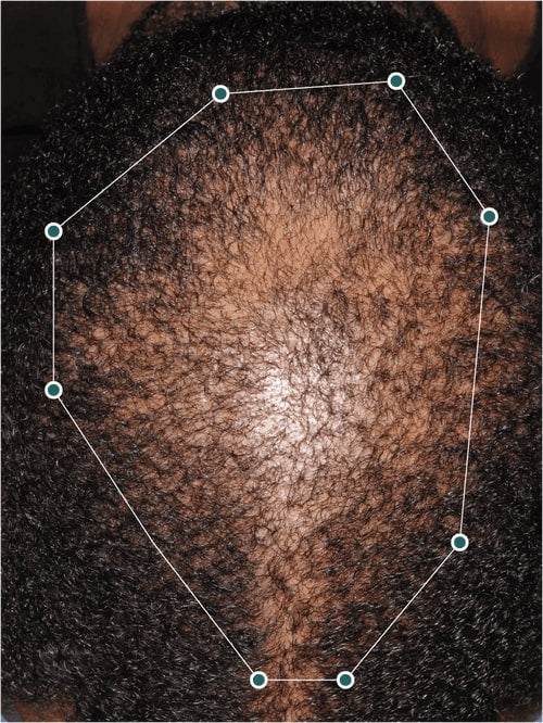 Nutrafol muški komplet za potpuni rast kose